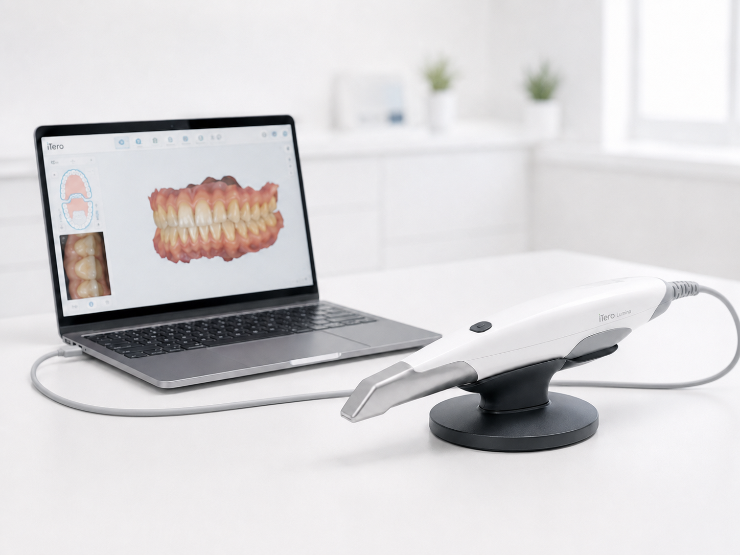 Intraoral scanner and laptop showing a digital dental scan