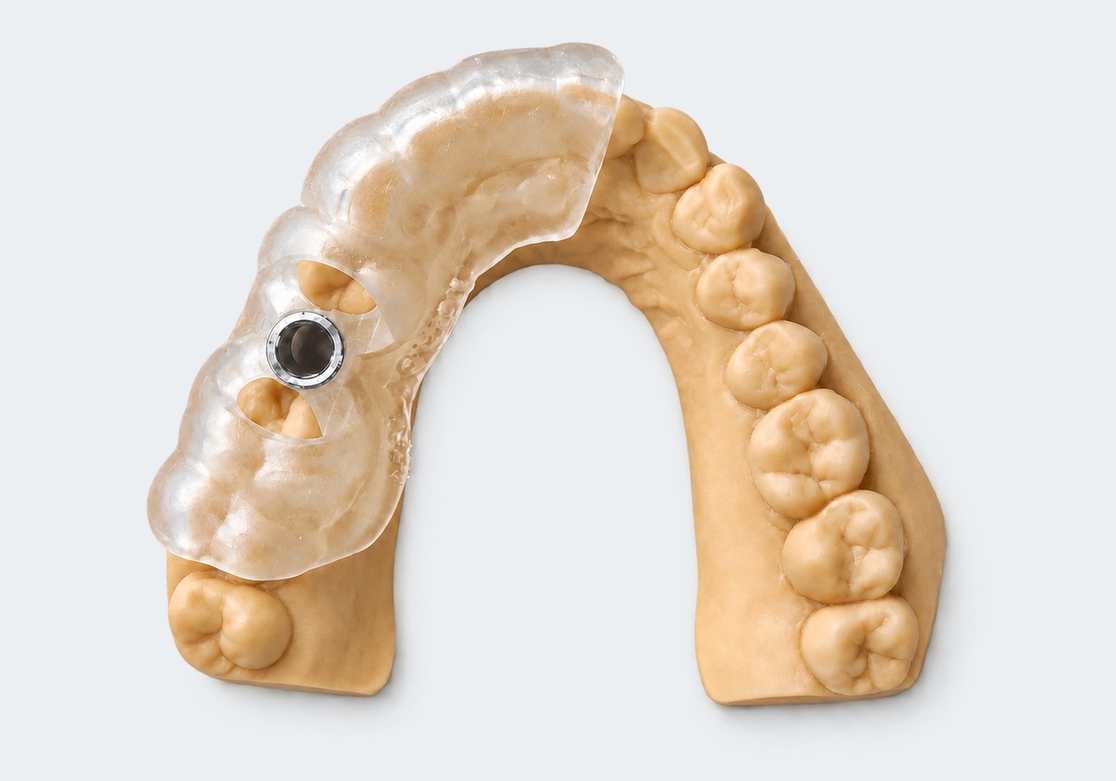 Implant surgical guide