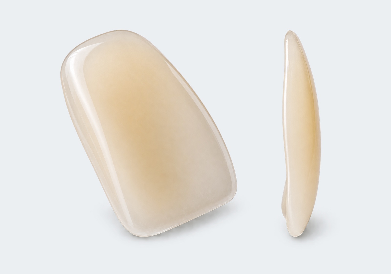 IPS e.max veneer