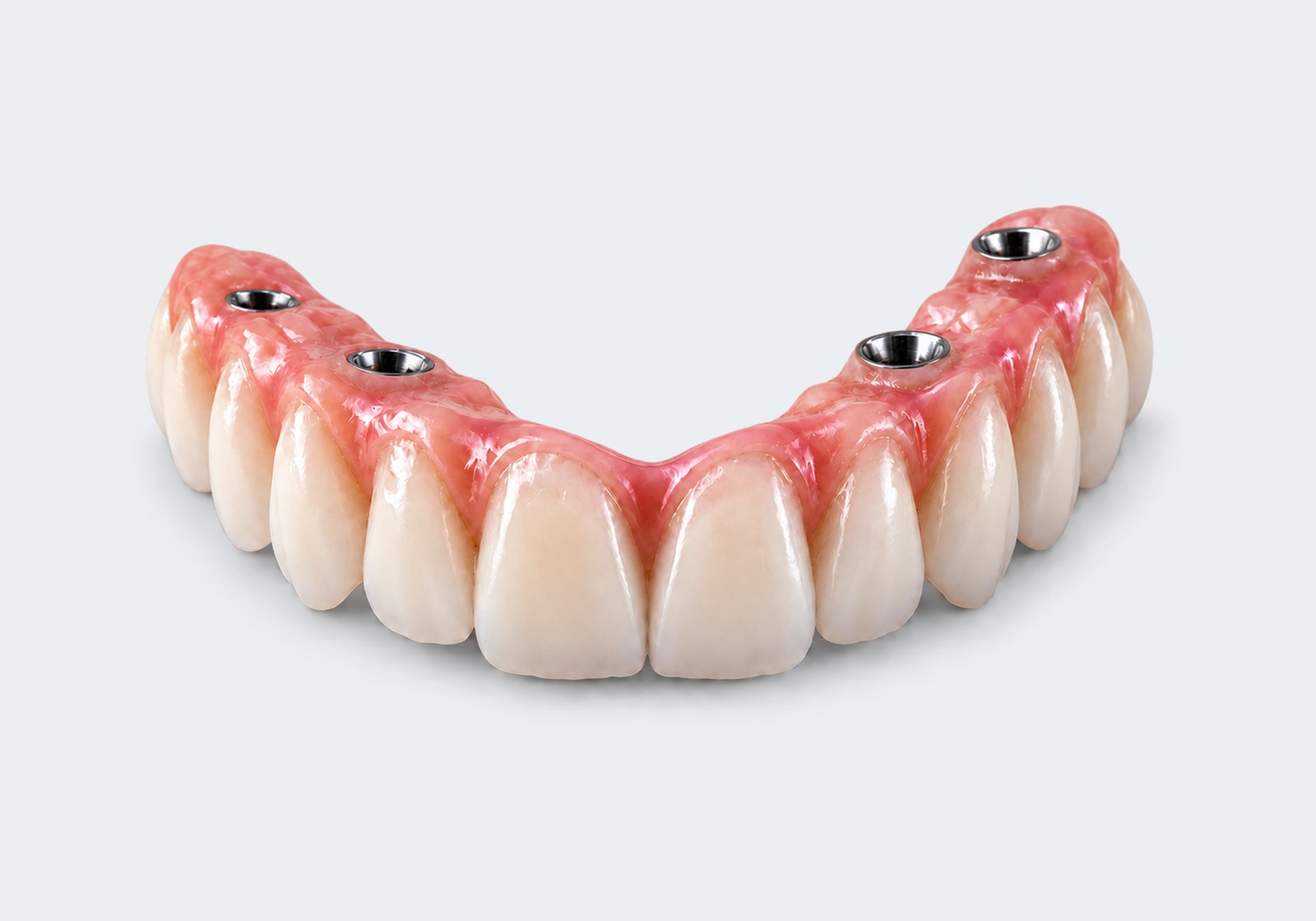 Implant supported arch All-on-4