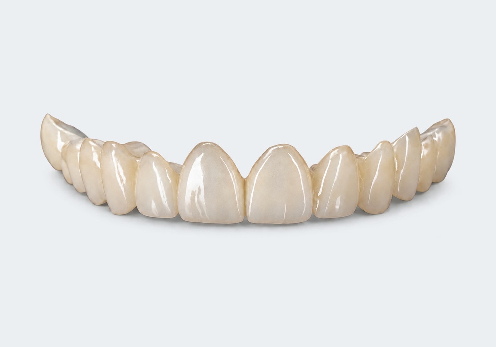 PMMA provisionals