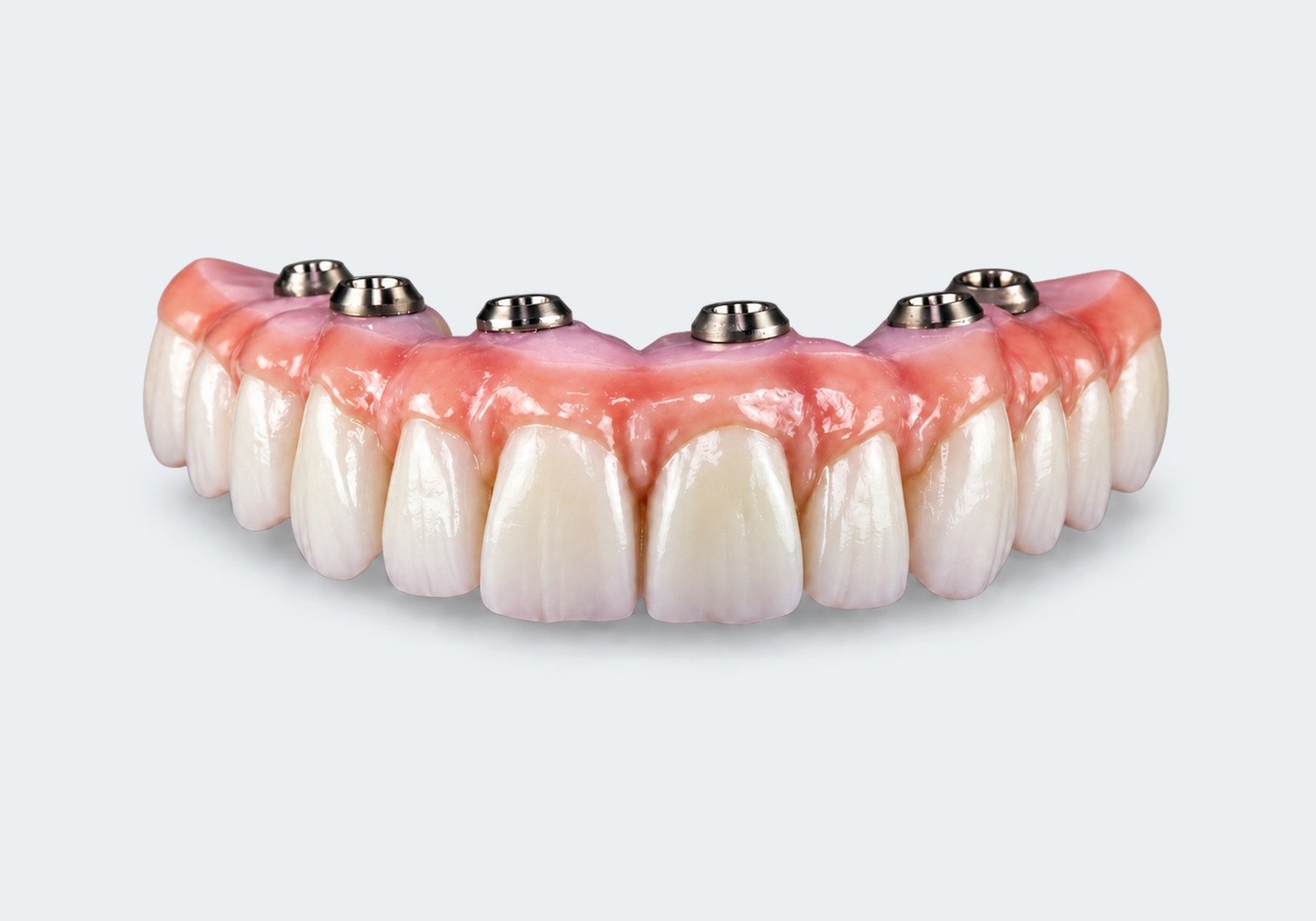 Implant supported arch All-on-6