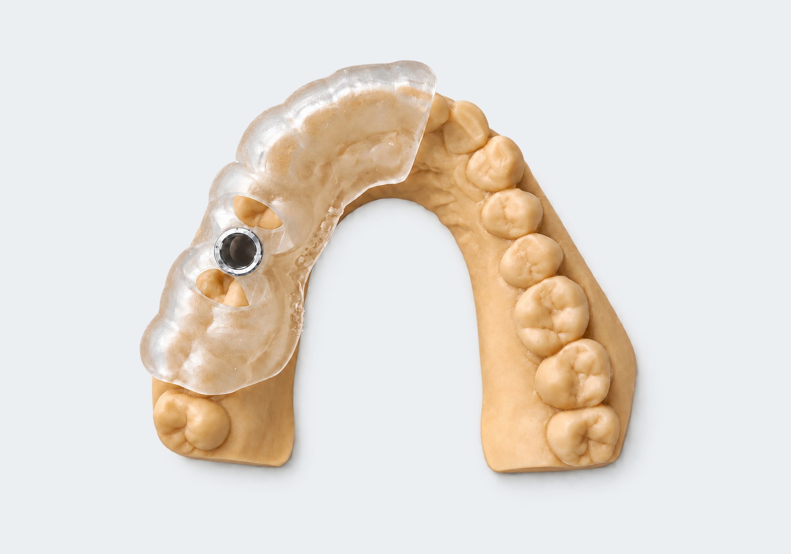 Dental implant surgical guide.