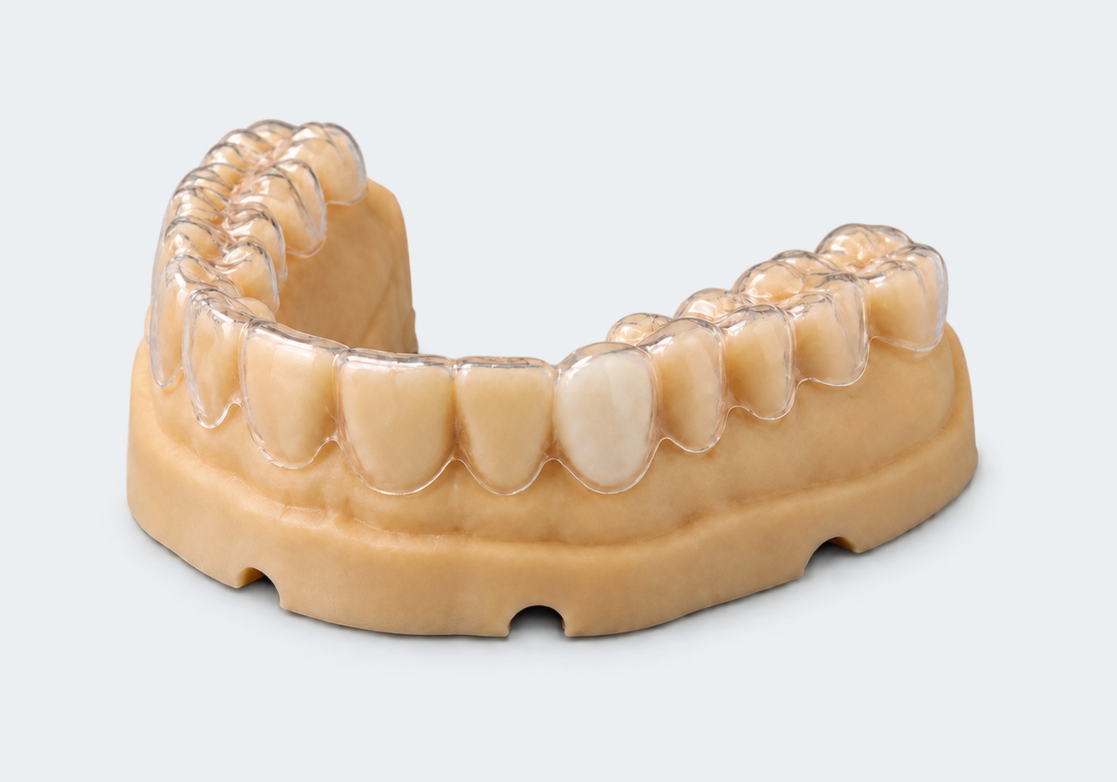 Essix retainer